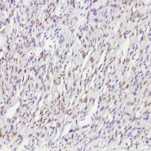 Estrogen Receptor Beta 2 Antibody in Immunohistochemistry (IHC (P))