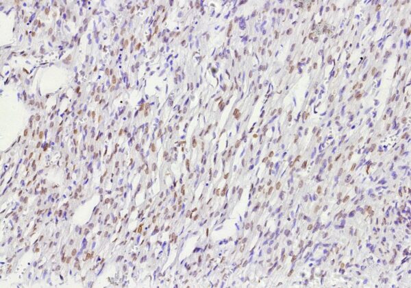 Estrogen Receptor Beta 2 Antibody in Immunohistochemistry (IHC (P))