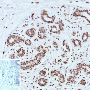 ESR2 Antibody in Immunohistochemistry (IHC (P))