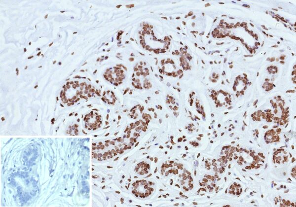 ESR2 Antibody in Immunohistochemistry (IHC (P))