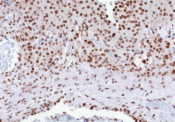 ESR2 Antibody in Immunohistochemistry (IHC (P))