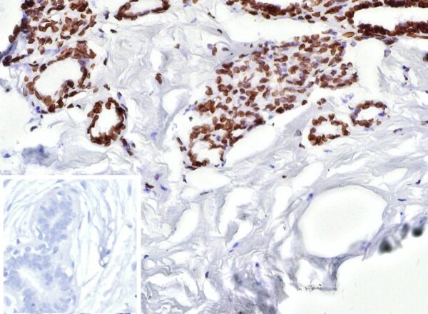 Estrogen Receptor Beta 2 Antibody in Immunohistochemistry (IHC (P))