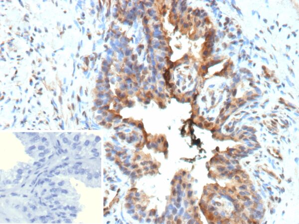 Galectin-3 Antibody in Immunohistochemistry (IHC (P))