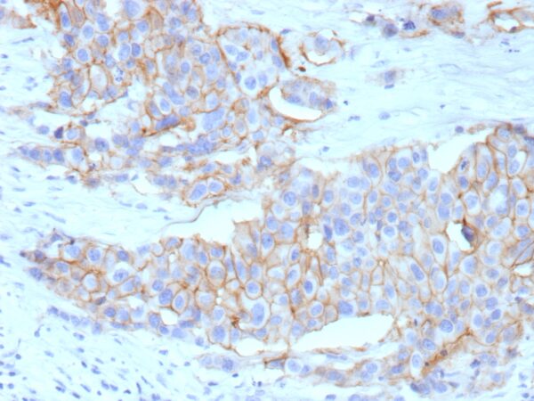 c-erbB-2 / HER-2 Antibody in Immunohistochemistry (IHC (P))