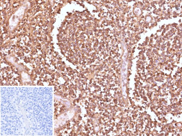 HLA-E Antibody in Immunohistochemistry (IHC (P))