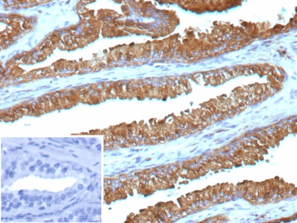 IDH1-R132G Antibody in Immunohistochemistry (IHC (P))