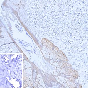 Maspin Antibody in Immunohistochemistry (IHC (P))