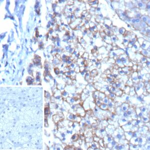 Multidrug Resistance-Associated Protein 3 Antibody in Immunohistochemistry (IHC (P))