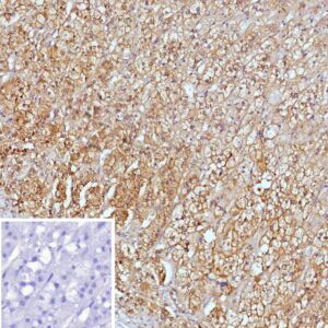 Maspin Antibody in Immunohistochemistry (IHC (P))