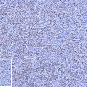 SALL4 Antibody in Immunohistochemistry (IHC (P))