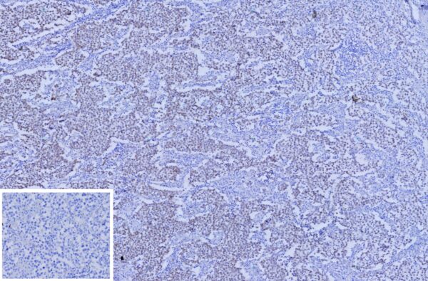 SALL4 Antibody in Immunohistochemistry (IHC (P))