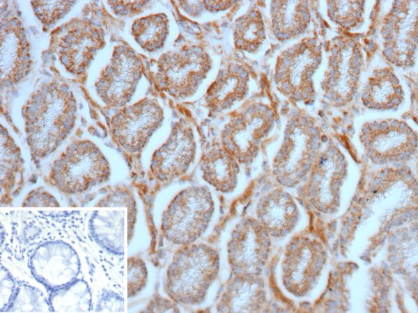 SLAMF7 Antibody in Immunohistochemistry (IHC (P))