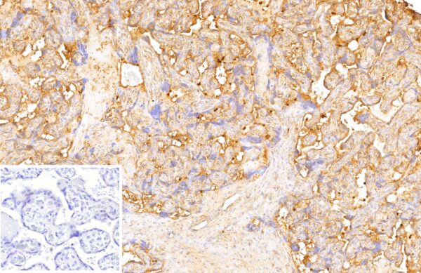 VEGI Antibody in Immunohistochemistry (IHC (P))