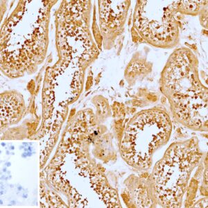 VEGI Antibody in Immunohistochemistry (IHC (P))