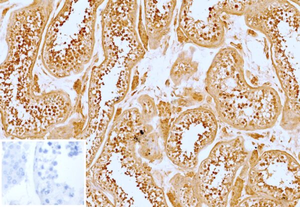 VEGI Antibody in Immunohistochemistry (IHC (P))