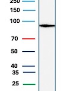 Cadherin 17 Antibody in Western Blot (WB)