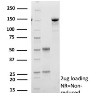 HSD17B13 Antibody in SDS-PAGE