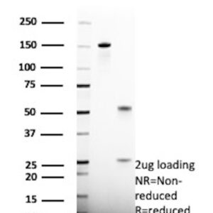 HSD17B13 Antibody in SDS-PAGE