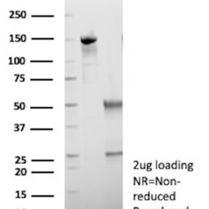 HSD17B13 Antibody in SDS-PAGE