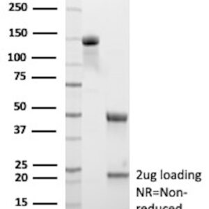 MUC13 Antibody in SDS-PAGE