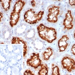 ACE2 Antibody in Immunohistochemistry (IHC (P))