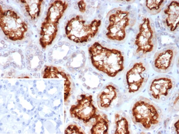 ACE2 Antibody in Immunohistochemistry (IHC (P))