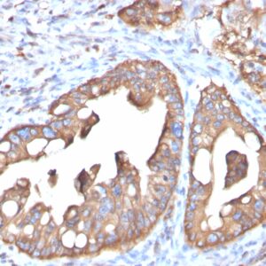 Aquaporin (AQP4) Antibody in Immunohistochemistry (IHC (P))