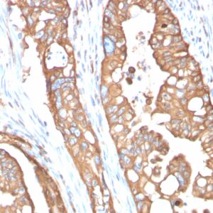 Aquaporin (AQP4) Antibody in Immunohistochemistry (IHC (P))