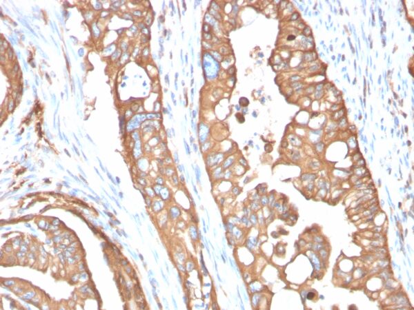 Aquaporin (AQP4) Antibody in Immunohistochemistry (IHC (P))