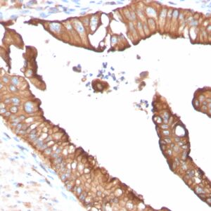 Aquaporin (AQP4) Antibody in Immunohistochemistry (IHC (P))