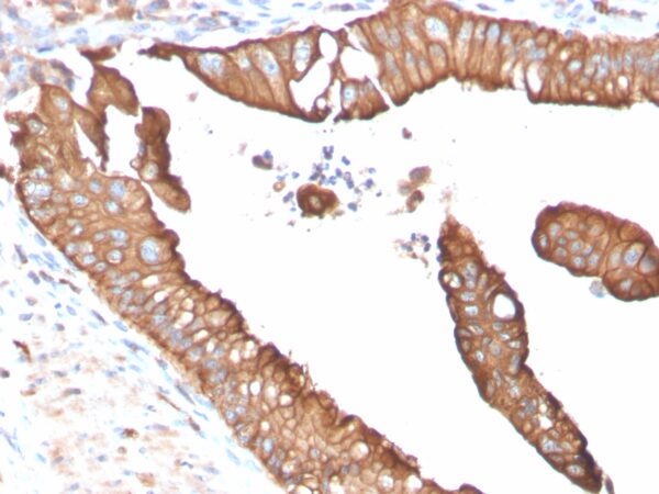 Aquaporin (AQP4) Antibody in Immunohistochemistry (IHC (P))