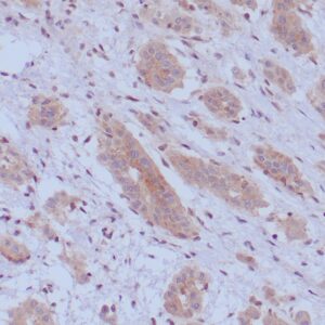 BAP1 Antibody in Immunohistochemistry (IHC (P))