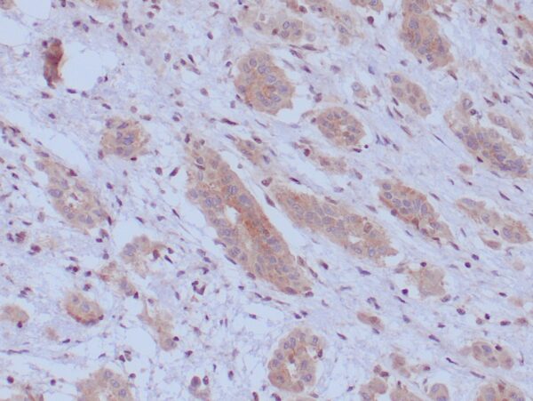 BAP1 Antibody in Immunohistochemistry (IHC (P))