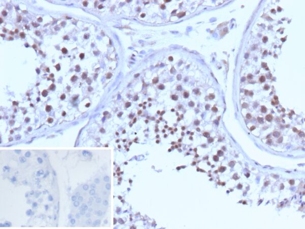 BRCA1 Antibody in Immunohistochemistry (IHC (P))