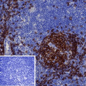 CD19 Antibody in Immunohistochemistry (IHC (P))