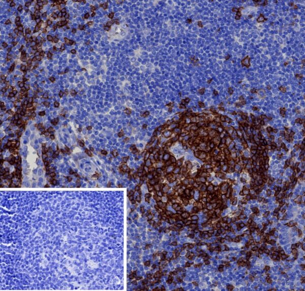 CD19 Antibody in Immunohistochemistry (IHC (P))