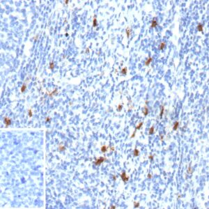 CD83 Antibody in Immunohistochemistry (IHC (P))