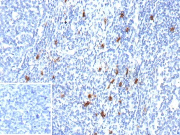 CD83 Antibody in Immunohistochemistry (IHC (P))