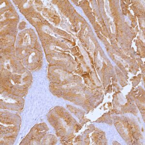 Cadherin 17 Antibody in Immunohistochemistry (IHC (P))