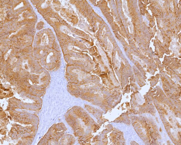 Cadherin 17 Antibody in Immunohistochemistry (IHC (P))