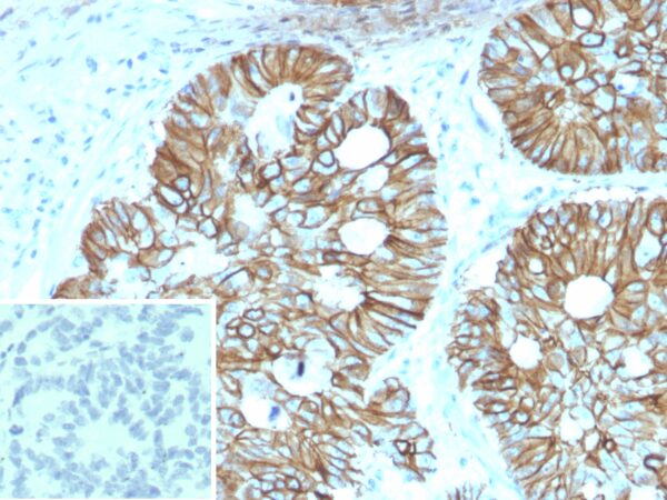 CDH17 Antibody in Immunohistochemistry (IHC (P))