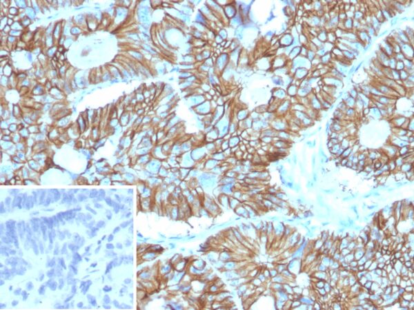 Cadherin 17 Antibody in Immunohistochemistry (IHC (P))