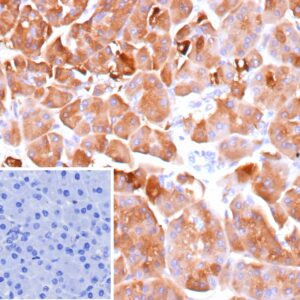 CELA3A Antibody in Immunohistochemistry (IHC (P))