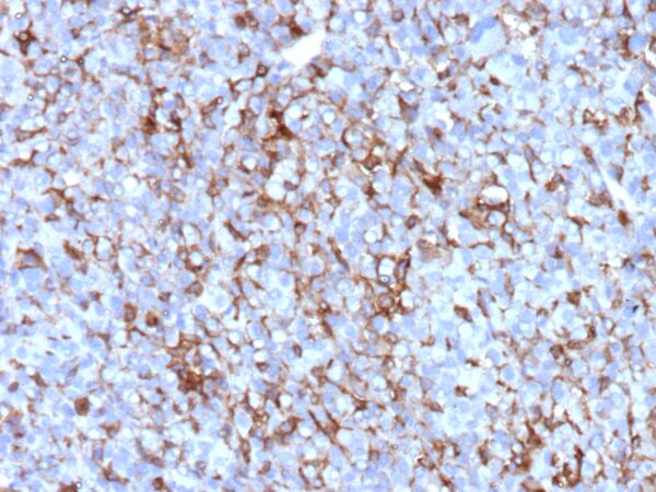 Clusterin Antibody in Immunohistochemistry (IHC (P))