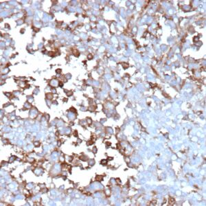 Clusterin Antibody in Immunohistochemistry (IHC (P))