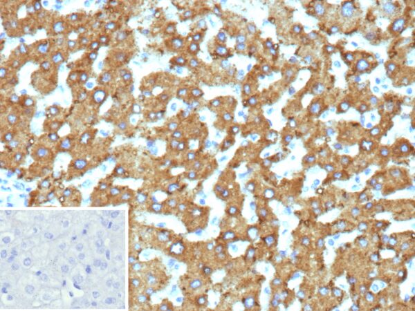 HSD17B13 Antibody in Immunohistochemistry (IHC (P))