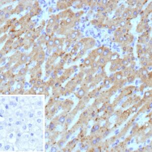 HSD17B13 Antibody in Immunohistochemistry (IHC (P))