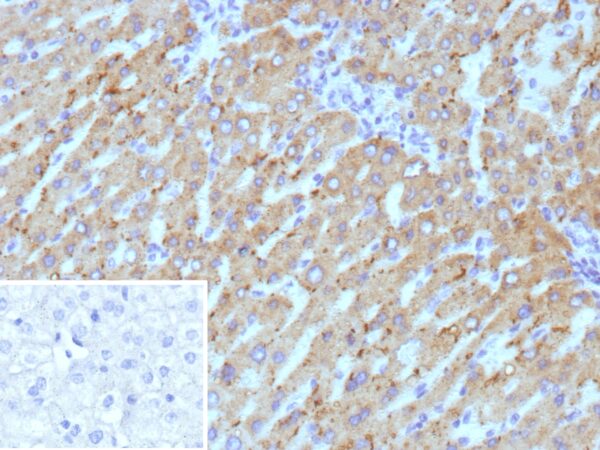 HSD17B13 Antibody in Immunohistochemistry (IHC (P))