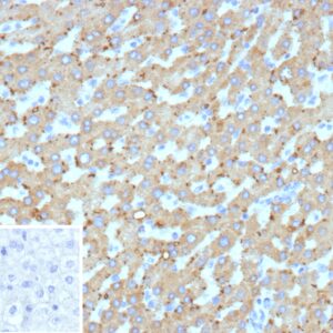 HSD17B13 Antibody in Immunohistochemistry (IHC (P))