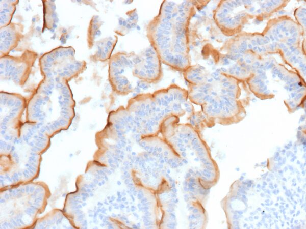 Mucin 13 Antibody in Immunohistochemistry (IHC (P))